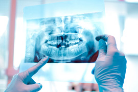 3D-снимок БЕСПЛАТНО